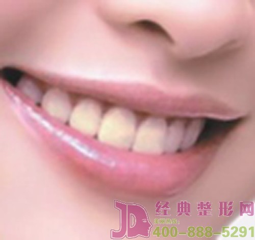 如何解决好做牙齿矫正的常见问题