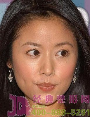 四川哪家醫(yī)院除皺好？