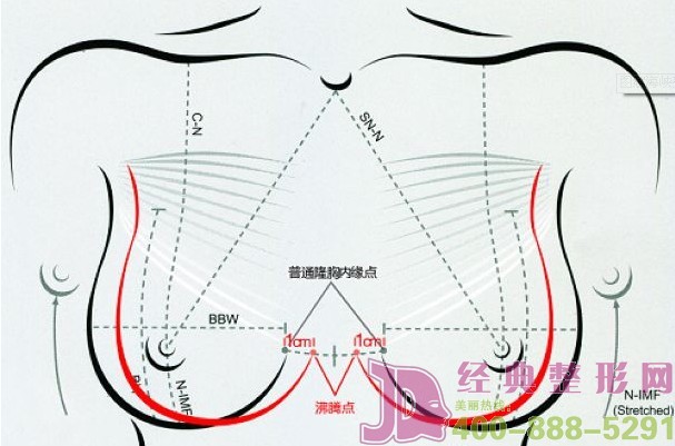 双胞姐妹事事求同 胸部size也要“复制” 