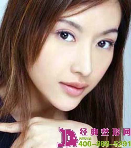 韩式隆鼻的优势