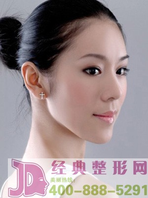 电波拉皮除皱美容保持时间多久呢？