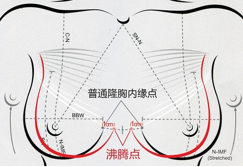 沸腾沟丰胸：明星突然“挺”起来？