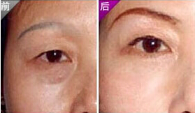 常州切眉價(jià)格