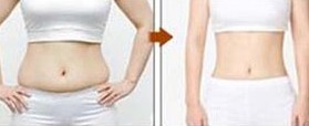 吉林腰腹部吸脂價(jià)格