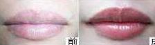 張家口漂唇價格