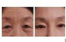 萍鄉面部懸吊價格