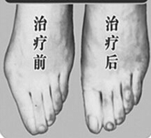 萍鄉(xiāng)寬腳變窄價格