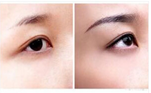 撫順紋眉術價格
