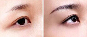 揚州眉再造價格