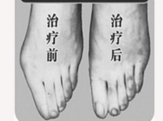 宿遷寬腳變窄價格