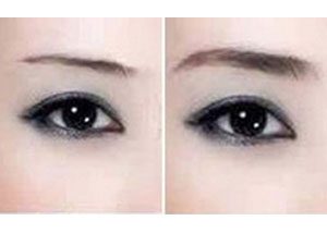 淄博提眉價(jià)格