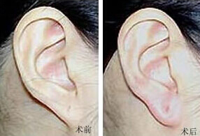 寧德耳垂加大價(jià)格