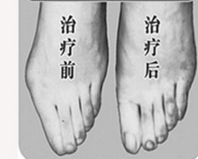 煙臺寬腳變窄價格