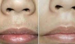 滄州脫絡腮胡價格