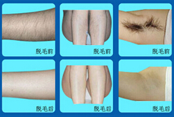 廊坊脫眉毛價格