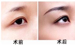 淄博眉毛種植價(jià)格
