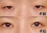 大理眼部綜合術(shù)價(jià)格
