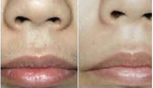 昭通脫唇毛價格