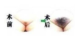 昭通美人尖種植價格