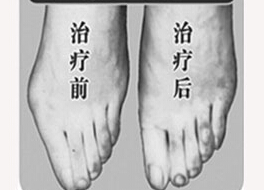 呂梁寬腳變窄價(jià)格