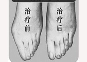 南充寬腳變窄價格