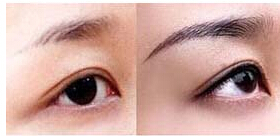 南通眉毛種植價(jià)格