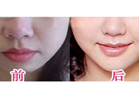 溫州漂唇價格