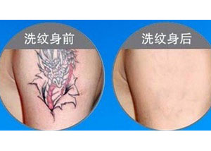 溫州去紋身價格