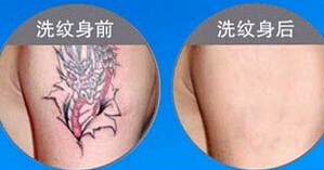 珠海去紋身價格