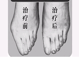 珠海寬腳變窄價格