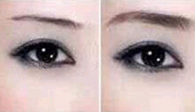 棗莊提眉價格