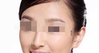 福州比华利隆鼻手术有哪些常用方法？