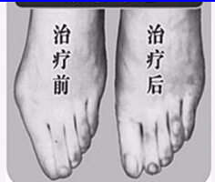 東莞寬腳變窄價格