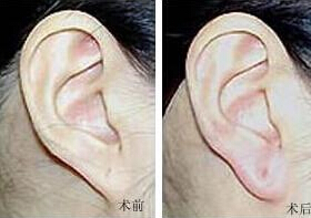 棗莊耳垂加大價格