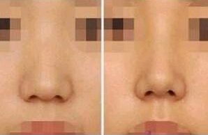 汕頭人中加深價格