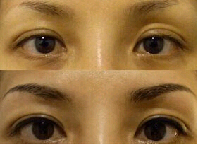 惠州眉毛種植價格