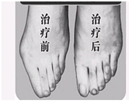 惠州寬腳變窄價格