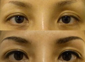 湖州眉毛種植價(jià)格
