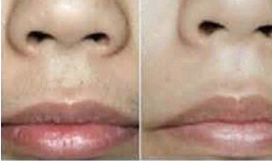 肇慶脫絡腮胡價格