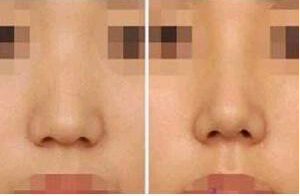 肇慶人中加深價格