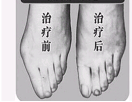 紹興寬腳變窄價格