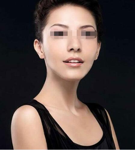 上海华美面部轮廓塑形注意事项