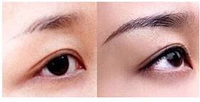 衢州眉毛種植價(jià)格