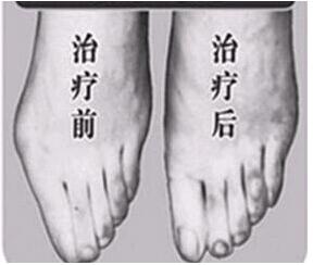 南平寬腳變窄價(jià)格