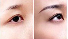 湛江繡眉價格