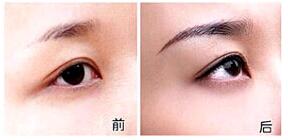 湛江切眉價格