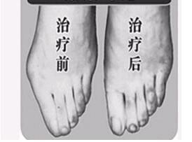 湛江寬腳變窄價格