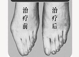 金華寬腳變窄價格