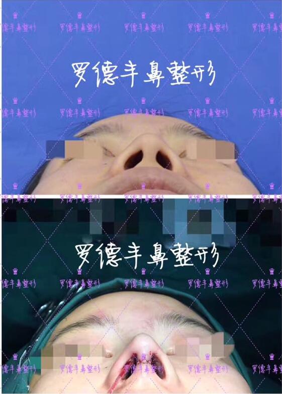 [ART_TITLE]
