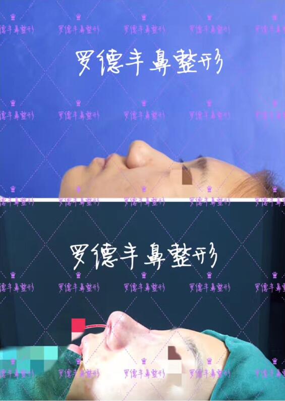[ART_TITLE]